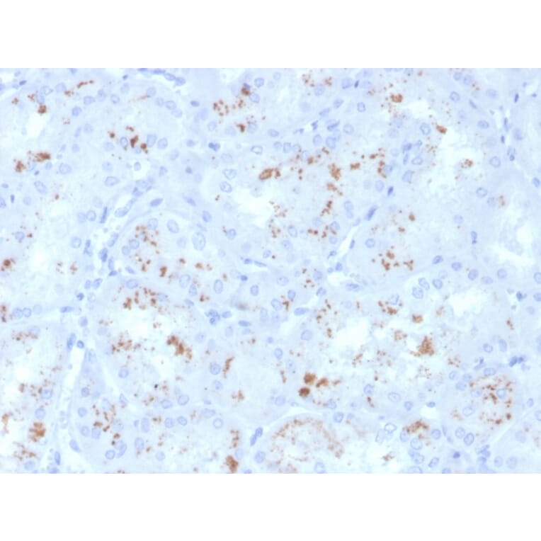 Immunohistochemistry - Anti-RBP4 Antibody [RBP4/4050] - BSA and Azide free (A253021) - Antibodies.com