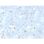 Immunohistochemistry - Anti-RBP4 Antibody [RBP4/4050] - BSA and Azide free (A253021) - Antibodies.com