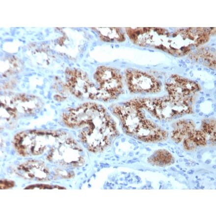 Immunohistochemistry - Anti-RBP4 Antibody [RBP4/4051] - BSA and Azide free (A253022) - Antibodies.com