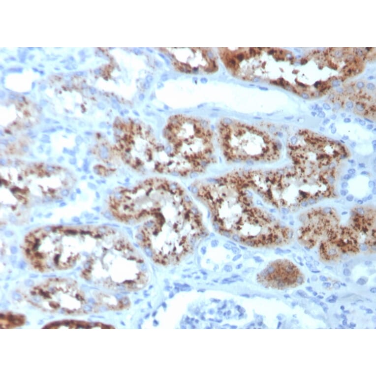 Immunohistochemistry - Anti-RBP4 Antibody [RBP4/4051] - BSA and Azide free (A253022) - Antibodies.com