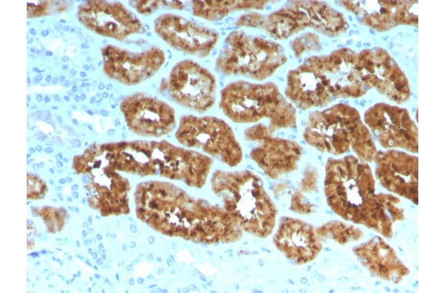 Immunohistochemistry - Anti-RBP4 Antibody [RBP4/4051] - BSA and Azide free (A253022) - Antibodies.com