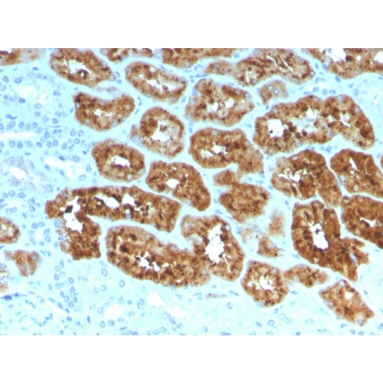 Immunohistochemistry - Anti-RBP4 Antibody [RBP4/4051] - BSA and Azide free (A253022) - Antibodies.com