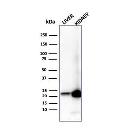 Western Blot - Anti-RBP4 Antibody [RBP4/4314] - BSA and Azide free (A253024) - Antibodies.com