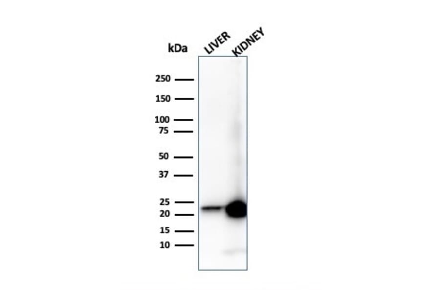 Western Blot - Anti-RBP4 Antibody [RBP4/4314] - BSA and Azide free (A253024) - Antibodies.com
