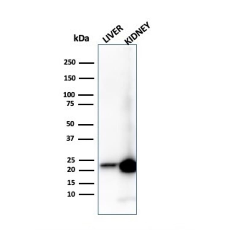 Western Blot - Anti-RBP4 Antibody [RBP4/4314] - BSA and Azide free (A253024) - Antibodies.com