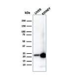 Western Blot - Anti-RBP4 Antibody [RBP4/4314] - BSA and Azide free (A253024) - Antibodies.com