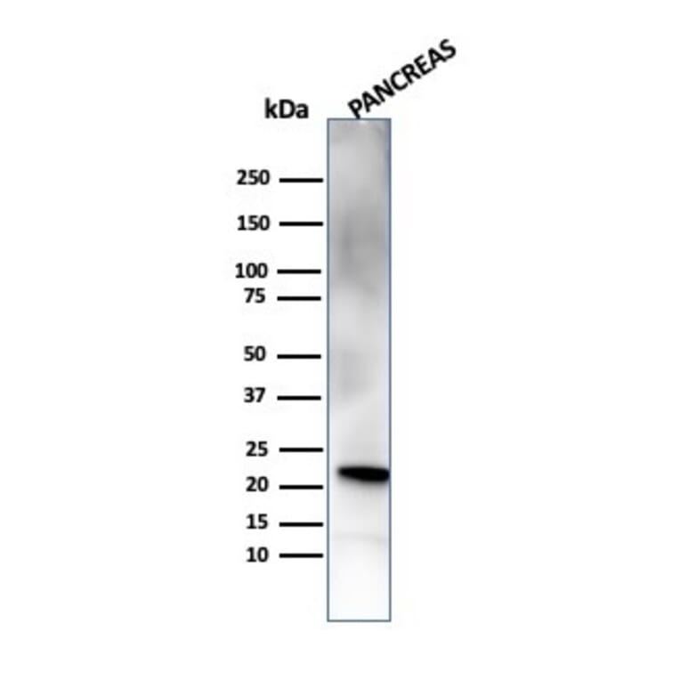 Western Blot - Anti-RBP4 Antibody [RBP4/4314] - BSA and Azide free (A253024) - Antibodies.com