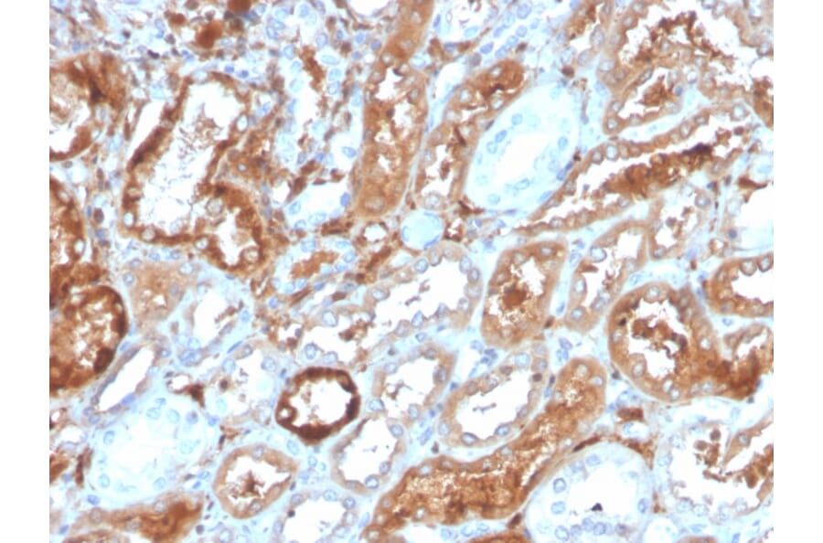 Immunohistochemistry - Anti-RBP4 Antibody [RBP4/4314] - BSA and Azide free (A253024) - Antibodies.com