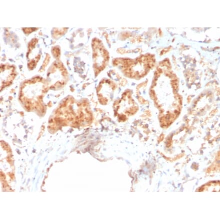 Immunohistochemistry - Anti-RBP4 Antibody [RBP4/4316] - BSA and Azide free (A253025) - Antibodies.com