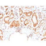 Immunohistochemistry - Anti-RBP4 Antibody [RBP4/4316] - BSA and Azide free (A253025) - Antibodies.com