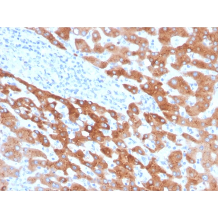 Immunohistochemistry - Anti-RBP4 Antibody [RBP4/4041] - BSA and Azide free (A253026) - Antibodies.com