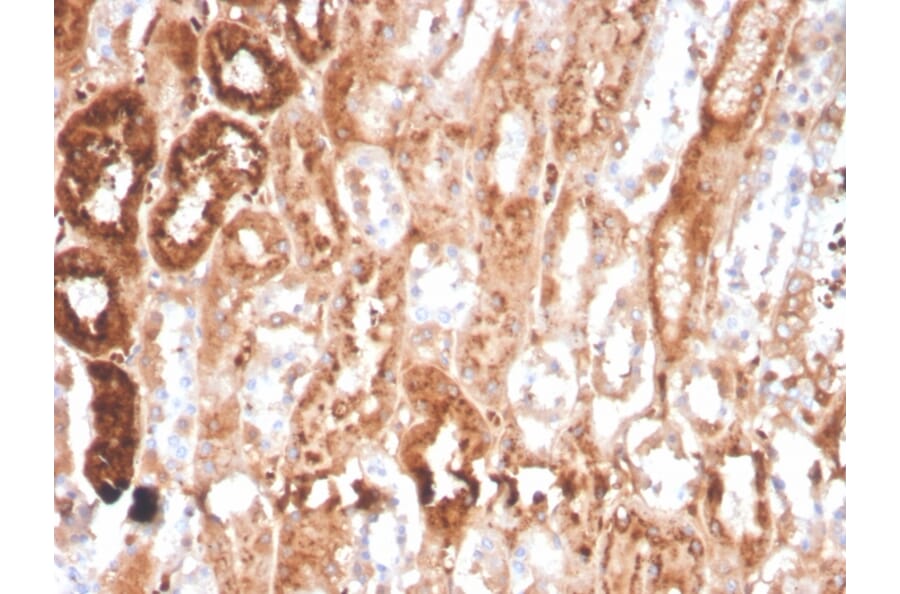 Immunohistochemistry - Anti-RBP4 Antibody [RBP4/4041] - BSA and Azide free (A253026) - Antibodies.com