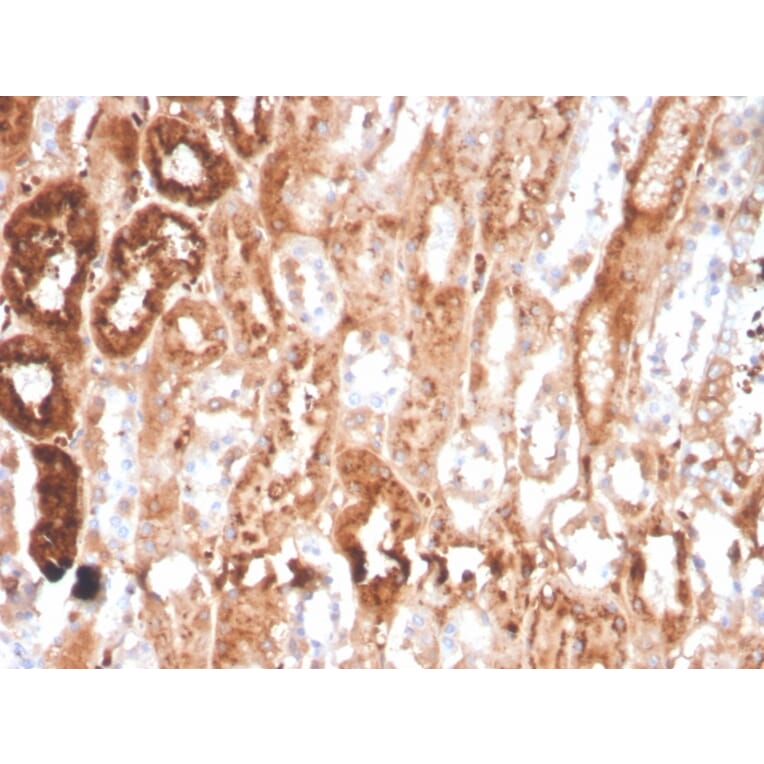Immunohistochemistry - Anti-RBP4 Antibody [RBP4/4041] - BSA and Azide free (A253026) - Antibodies.com