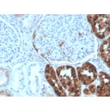 Immunohistochemistry - Anti-RBP4 Antibody [RBP4/4320] - BSA and Azide free (A253027) - Antibodies.com