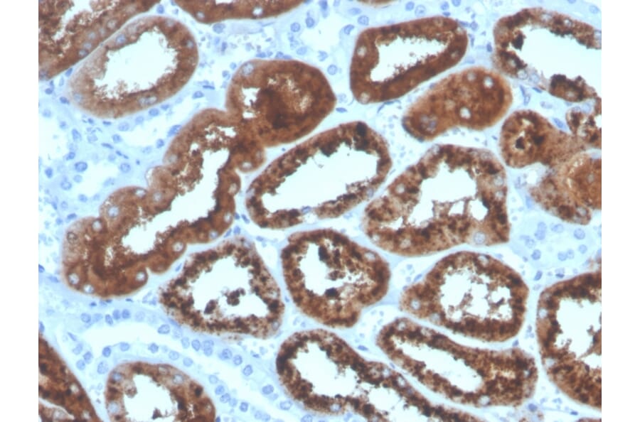 Immunohistochemistry - Anti-RBP4 Antibody [RBP4/4320] - BSA and Azide free (A253027) - Antibodies.com