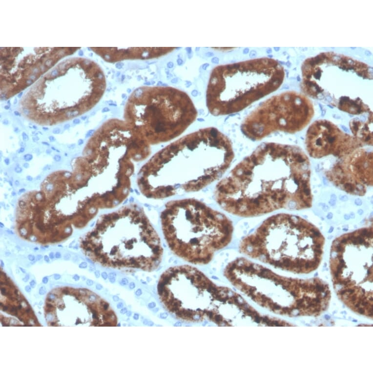 Immunohistochemistry - Anti-RBP4 Antibody [RBP4/4320] - BSA and Azide free (A253027) - Antibodies.com