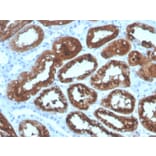 Immunohistochemistry - Anti-RBP4 Antibody [RBP4/4320] - BSA and Azide free (A253027) - Antibodies.com