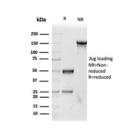 SDS-PAGE - Anti-RBP4 Antibody [RBP4/4042] - BSA and Azide free (A253028) - Antibodies.com