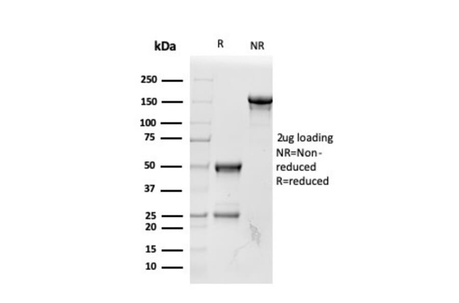 SDS-PAGE - Anti-RBP4 Antibody [RBP4/4042] - BSA and Azide free (A253028) - Antibodies.com