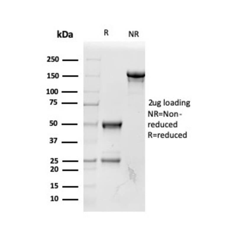SDS-PAGE - Anti-RBP4 Antibody [RBP4/4042] - BSA and Azide free (A253028) - Antibodies.com