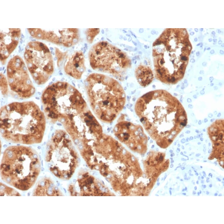 Immunohistochemistry - Anti-RBP4 Antibody [RBP4/4042] - BSA and Azide free (A253028) - Antibodies.com