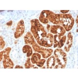 Immunohistochemistry - Anti-RBP4 Antibody [RBP4/4044] - BSA and Azide free (A253030) - Antibodies.com