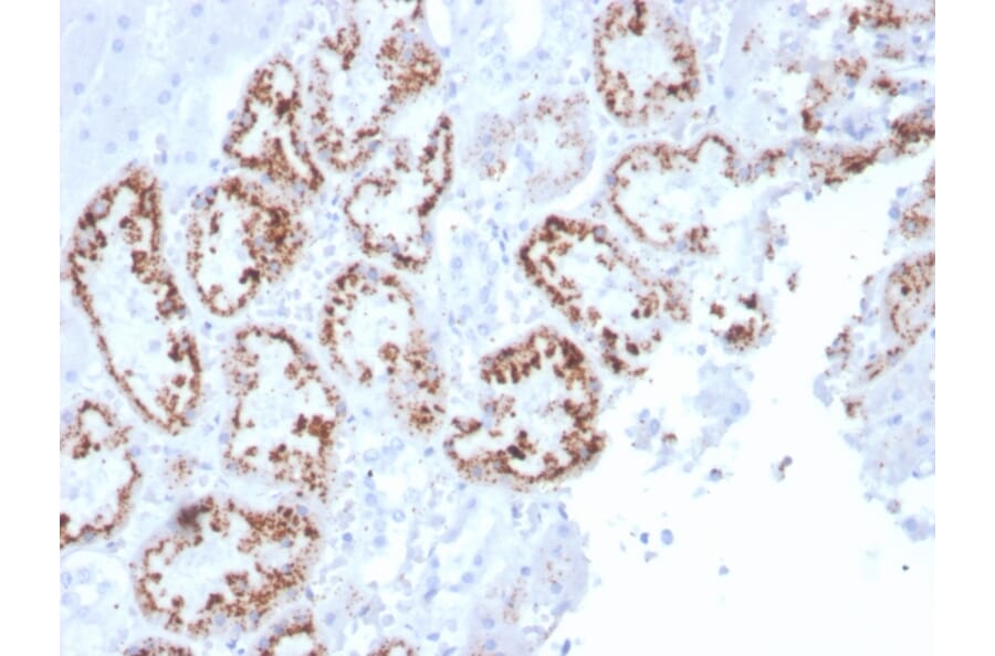 Immunohistochemistry - Anti-RBP4 Antibody [RBP4/4045] - BSA and Azide free (A253031) - Antibodies.com