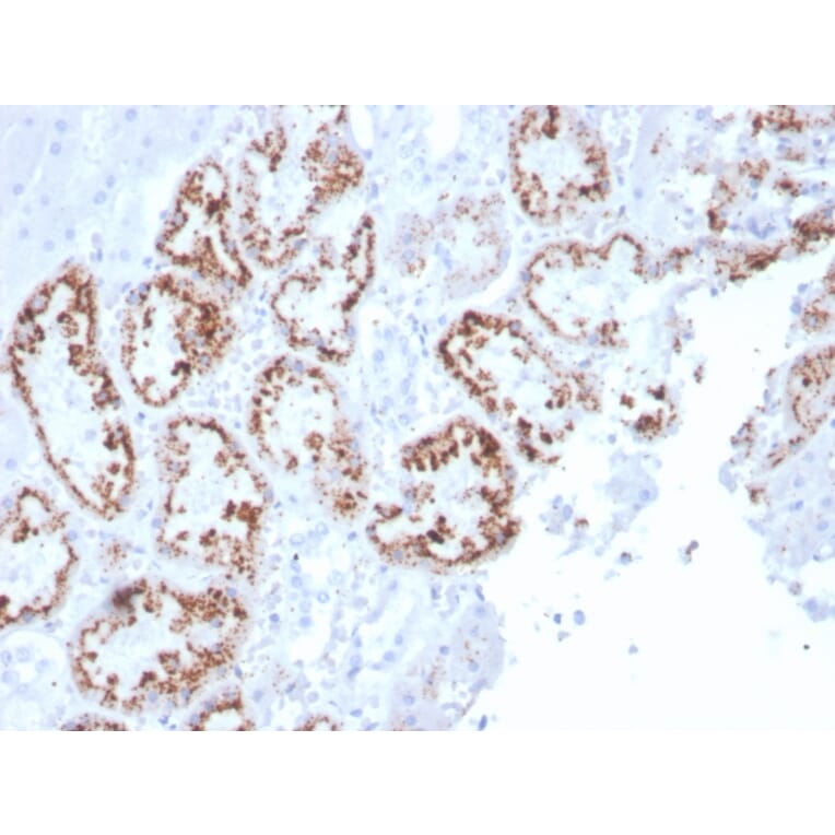 Immunohistochemistry - Anti-RBP4 Antibody [RBP4/4045] - BSA and Azide free (A253031) - Antibodies.com