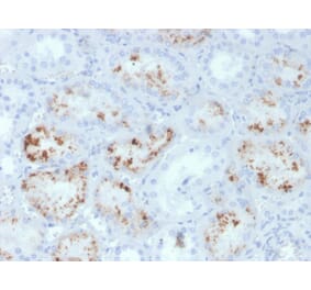 Immunohistochemistry - Anti-RBP4 Antibody [RBP4/4047] - BSA and Azide free (A253032) - Antibodies.com