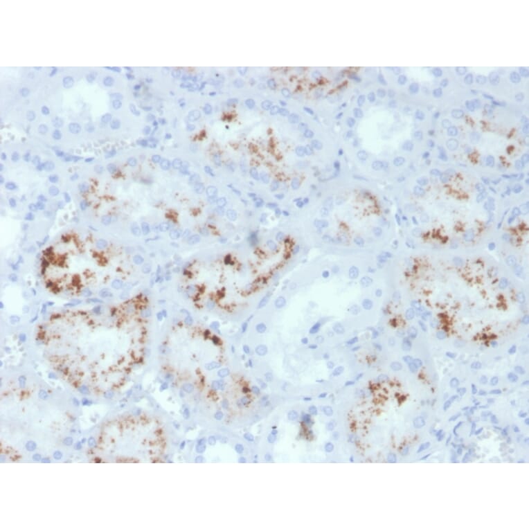 Immunohistochemistry - Anti-RBP4 Antibody [RBP4/4047] - BSA and Azide free (A253032) - Antibodies.com