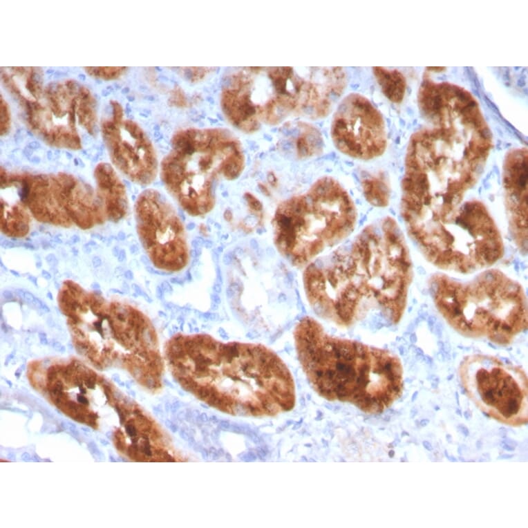 Immunohistochemistry - Anti-RBP4 Antibody [RBP4/4049] - BSA and Azide free (A253034) - Antibodies.com