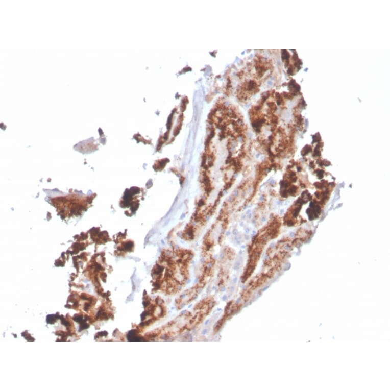 Immunohistochemistry - Anti-RBP4 Antibody [RBP4/4049] - BSA and Azide free (A253034) - Antibodies.com