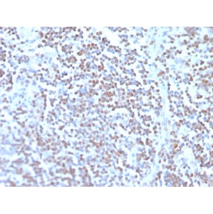 Immunohistochemistry - Anti-Cyclin D1 Antibody [rCCND1/4752] - BSA and Azide free (A253034) - Antibodies.com