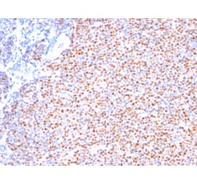 Immunohistochemistry - Anti-Cyclin D1 Antibody [SPM587] - BSA and Azide free (A253036) - Antibodies.com