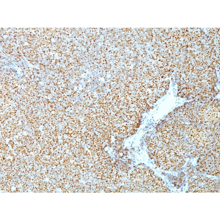 Immunohistochemistry - Anti-Cyclin D1 Antibody [CCND1/809] - BSA and Azide free (A253038) - Antibodies.com