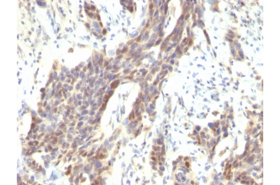 Immunohistochemistry - Anti-Cyclin D1 Antibody [CCND1/809] - BSA and Azide free (A253038) - Antibodies.com