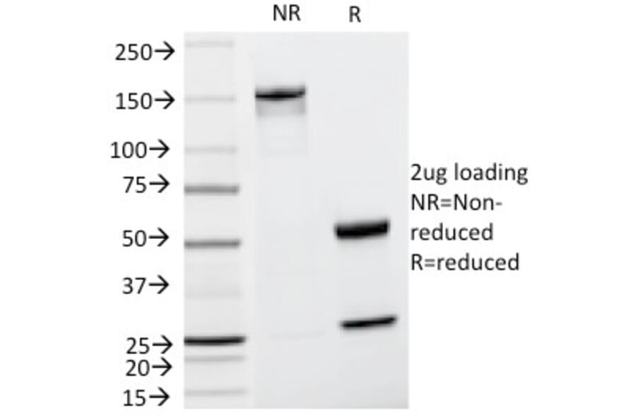 SDS-PAGE - Anti-Cyclin D1 Antibody [CCND1/809] - BSA and Azide free (A253038) - Antibodies.com