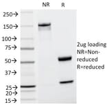 SDS-PAGE - Anti-Cyclin D1 Antibody [CCND1/809] - BSA and Azide free (A253038) - Antibodies.com
