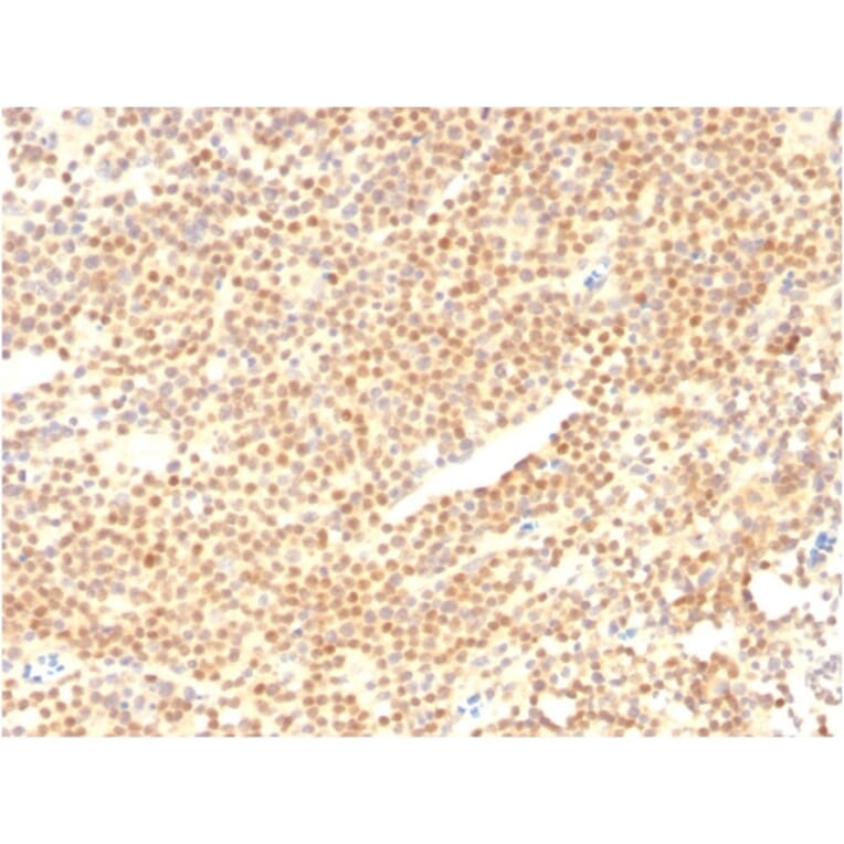Immunohistochemistry - Anti-Cyclin D1 Antibody [CCND1/2593] - BSA and Azide free (A253039) - Antibodies.com