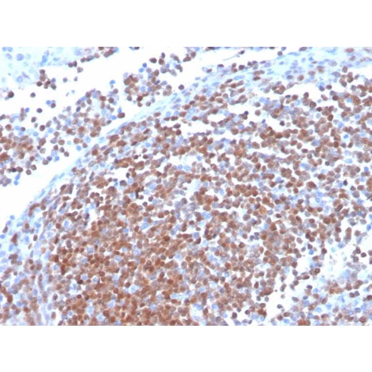 Immunohistochemistry - Anti-Cyclin D1 Antibody [CCND1/3370R] - BSA and Azide free (A253041) - Antibodies.com