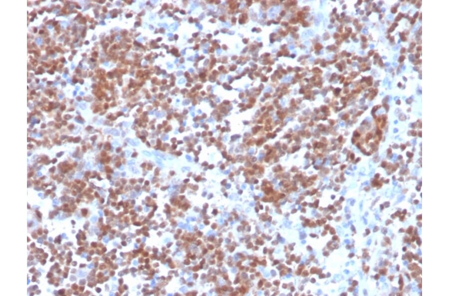 Immunohistochemistry - Anti-Cyclin D1 Antibody [CCND1/3370R] - BSA and Azide free (A253040) - Antibodies.com