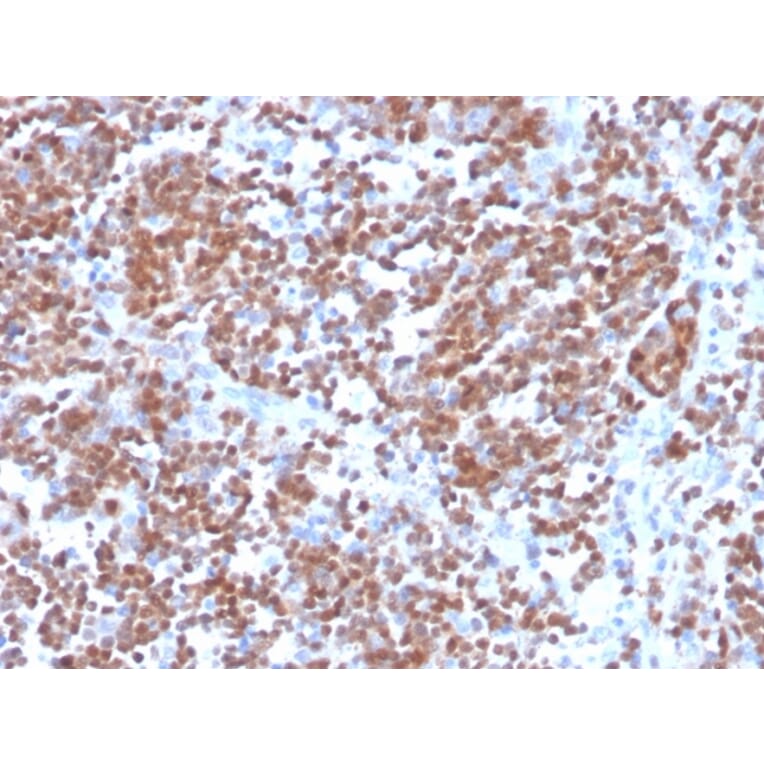 Immunohistochemistry - Anti-Cyclin D1 Antibody [CCND1/3370R] - BSA and Azide free (A253040) - Antibodies.com