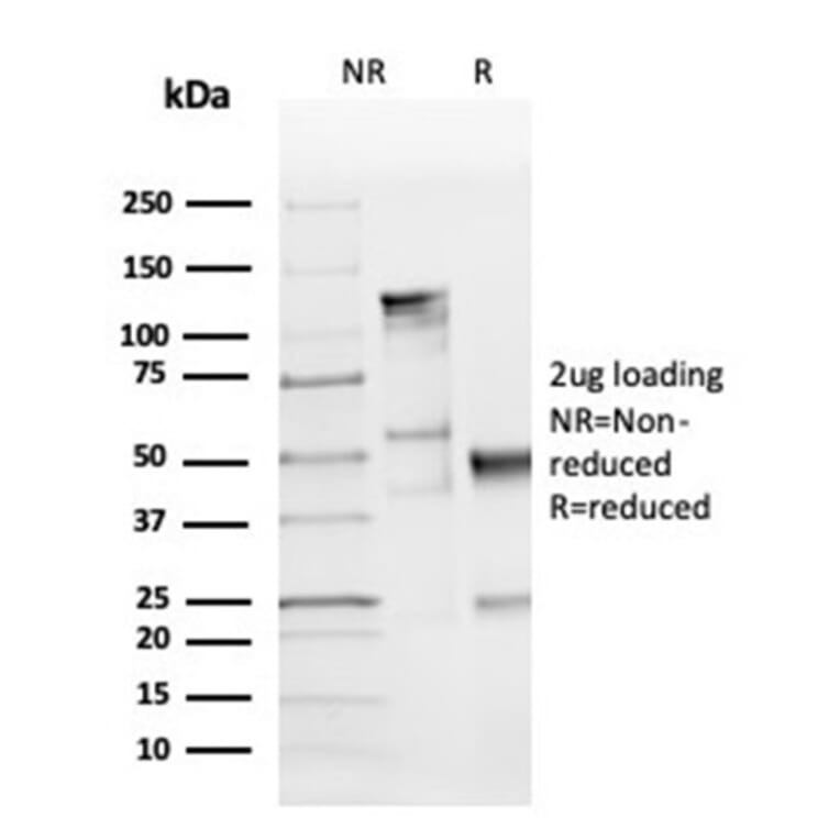 SDS-PAGE - Anti-Cyclin D1 Antibody [CCND1/3370R] - BSA and Azide free (A253041) - Antibodies.com