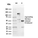 SDS-PAGE - Anti-Cyclin D1 Antibody [CCND1/3370R] - BSA and Azide free (A253041) - Antibodies.com