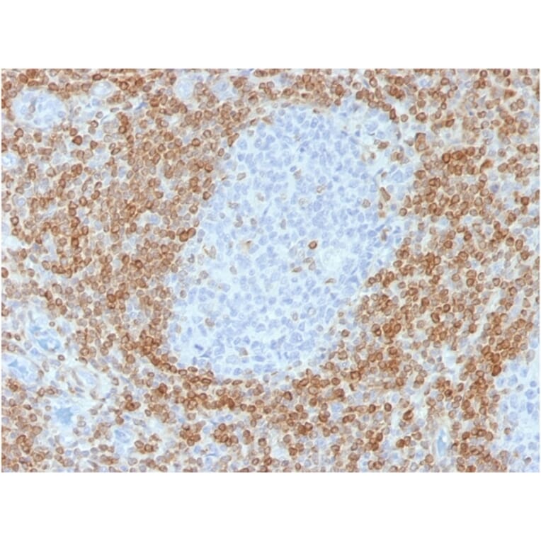Immunohistochemistry - Anti-Bcl-2 Antibody [rBCL2/782] - BSA and Azide free (A253042) - Antibodies.com