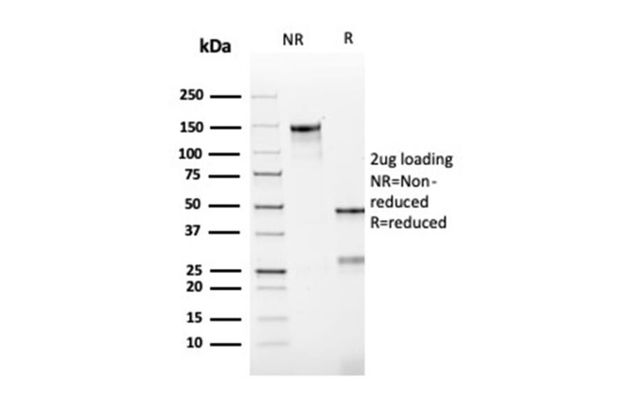 SDS-PAGE - Anti-Bcl-2 Antibody [rBCL2/782] - BSA and Azide free (A253042) - Antibodies.com