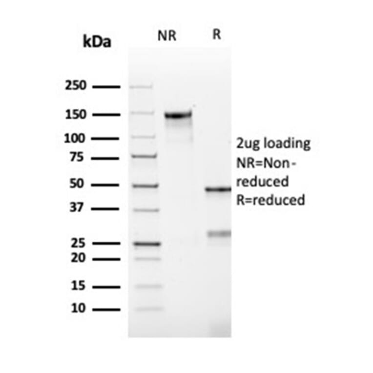 SDS-PAGE - Anti-Bcl-2 Antibody [rBCL2/782] - BSA and Azide free (A253042) - Antibodies.com