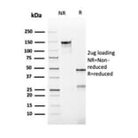 SDS-PAGE - Anti-Bcl-2 Antibody [rBCL2/782] - BSA and Azide free (A253042) - Antibodies.com