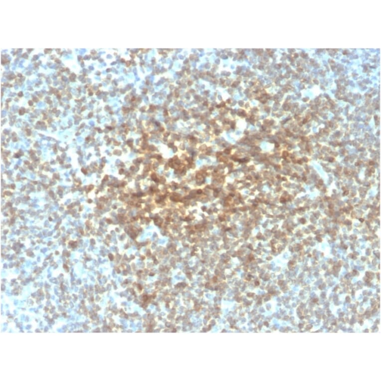 Immunohistochemistry - Anti-Bcl-2 Antibody [rBCL2/782] - BSA and Azide free (A253042) - Antibodies.com