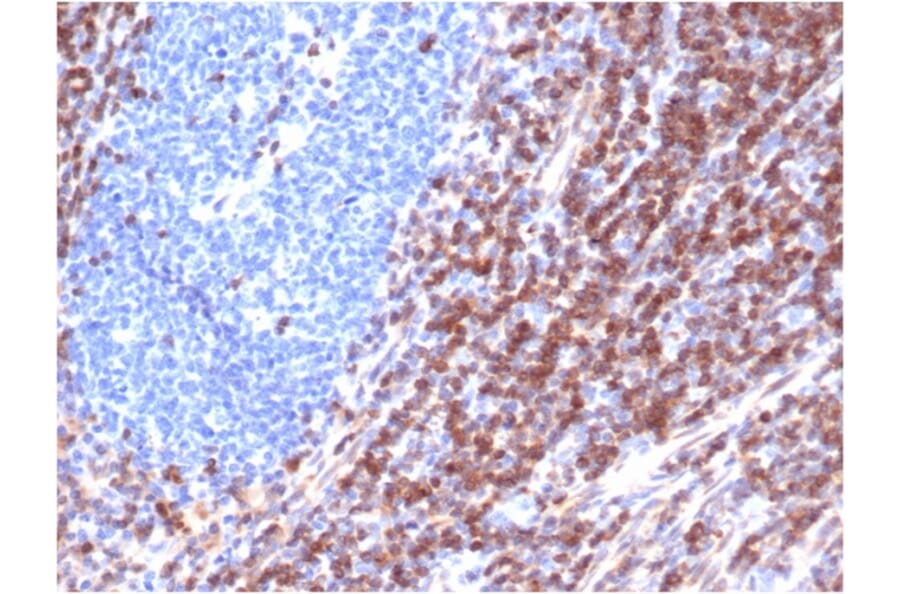 Immunohistochemistry - Anti-Bcl-2 Antibody [rBCL2/6418] - BSA and Azide free (A253042) - Antibodies.com